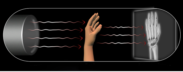 Properties of x-ray