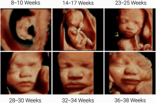 3D Ultrasound Radiologystar 3d-ultrasound-radiologystar