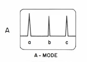 Ultrasound Mode Display