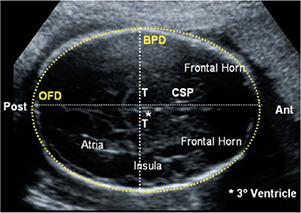 Fetal Pole