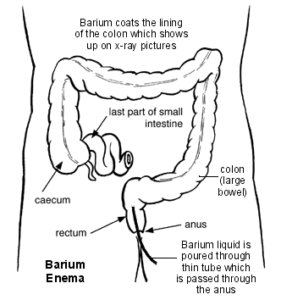 Large Intestine
