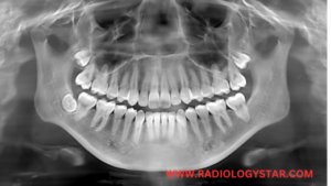 Dental X-ray