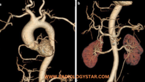 Angiography in x-rar