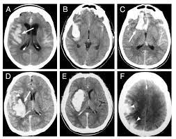 X-RAY OF CT IMAGE