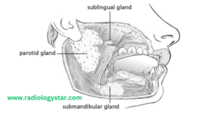 Sialography
