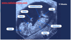 11 Week Ultrasound